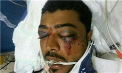 شهادت جوان بحرینی بر اثر اصابت مستقیم گلوله به سرش+عکس