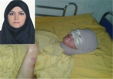 سزای پدری که به دخترش اسید پاشید+تصاویر