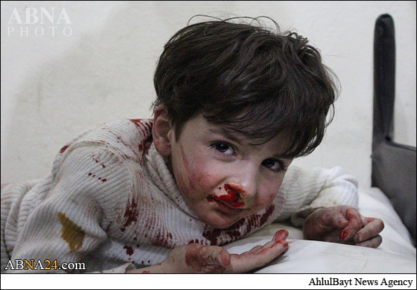 کودکان سوری قربانی حملات موشکی تکفیری‌ ها +عکس