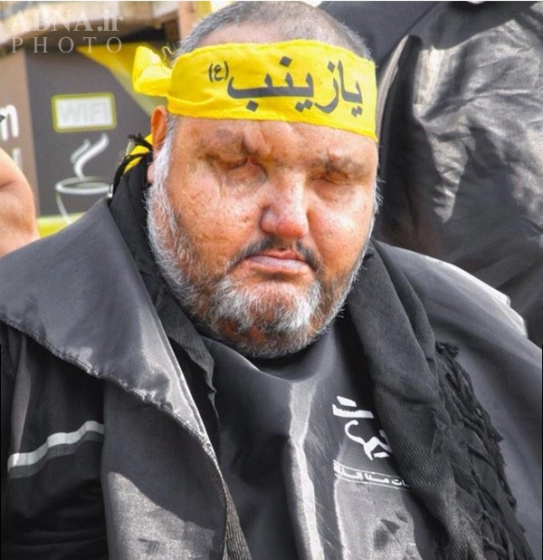 جانباز حزب‌الله؛به چشمانش نگاه نکنید!+عکس