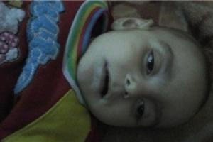 شهادت دختربچه سوری در الفوعه ادلب +عکس