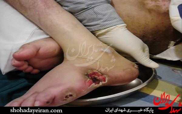نمایش زخم بستر جانباز مقابل بنیاد شهید/ حمله ماموران حراست به همسر جانباز