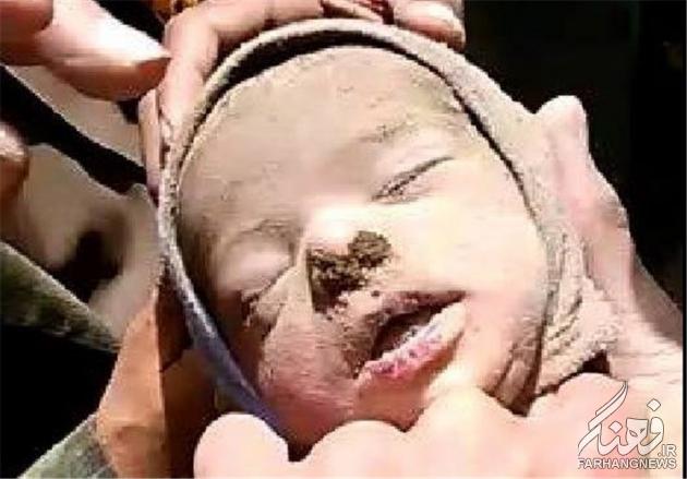 تصویری دلخراش از شهادت نوزاد ۱۲روزه یمنی