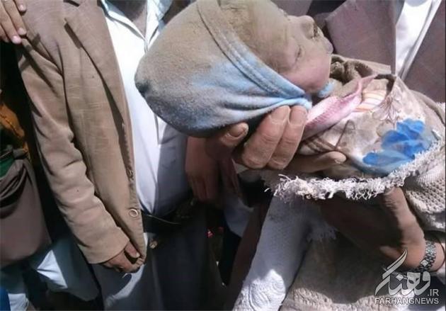 تصویری دلخراش از شهادت نوزاد ۱۲روزه یمنی