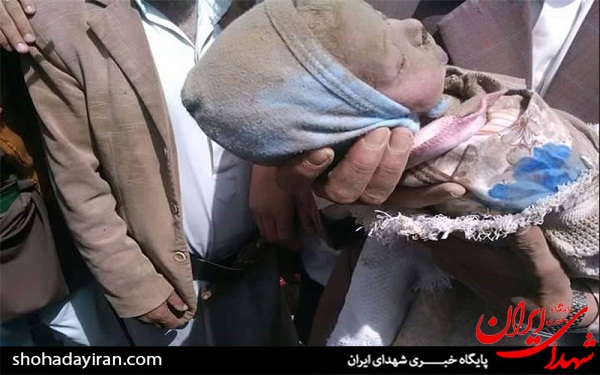 عکس/ شهادت نوزاد ۱۲ روزه یمنی در حملات عربستان
