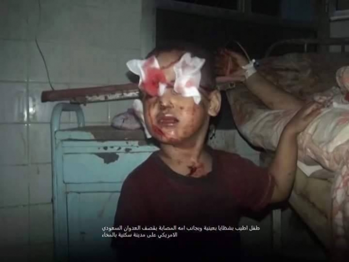 قانای یمن؛جنایتی که عربستان را در تنگنا گذاشت