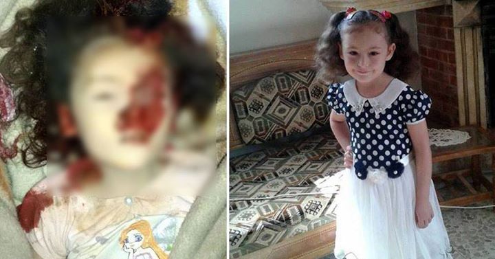 دختربچه‌ای که در حملات روسیه کشته شد+عکس