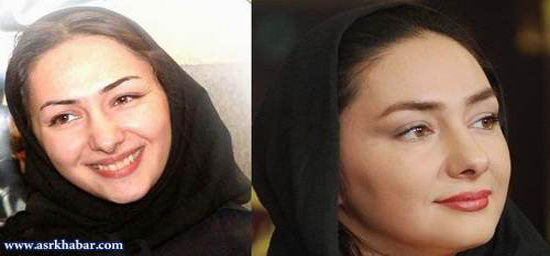 تفاوت چهره بازیگران زن، قبل و بعد از عمل زیبایی +تصاویر