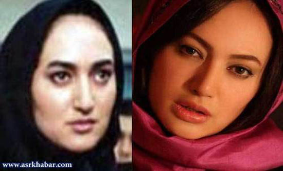 تفاوت چهره بازیگران زن، قبل و بعد از عمل زیبایی +تصاویر