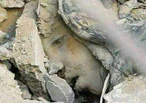 کودکی که زیر بمباران سعودی‌ها،دفن شد!+عکس