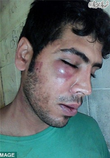 حمله پلیس گینه‎‏نو به دو مهاجر ایرانی +عکس