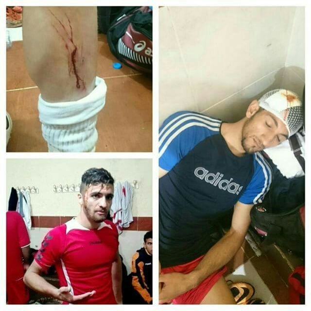 یک درگیری خونبار در لیگ فوتبال ایران!+عکس