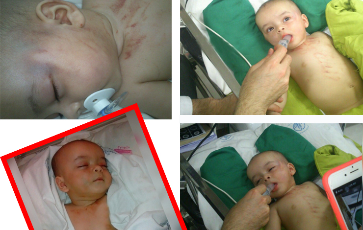 آزار دلخراش یک نوزاد 5 ماهه در رشت؟!+عکس