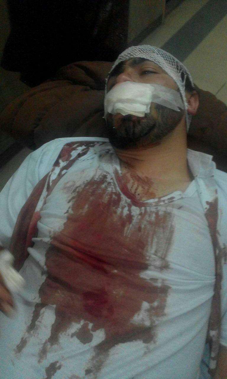 ضرب و شتم یک فعال دانشجویی در همدان! + عکس