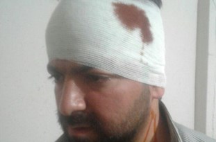 ضرب و شتم مدیر خبرگزاری فارس در قزوین+عکس