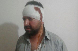 ضرب و شتم مدیر خبرگزاری فارس در قزوین+عکس