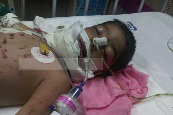 حمله گرگ به کودک سنقری / متین درگذشت +عکس