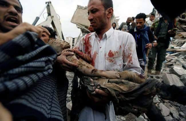 تصاویر هولناک از قربانیان جنایت جدید آل‌سعود در یمن