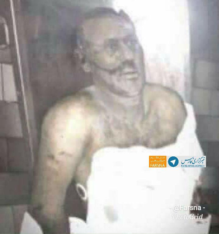 عکسی منتشر شده از جسد عبدالله صالح در سردخانه