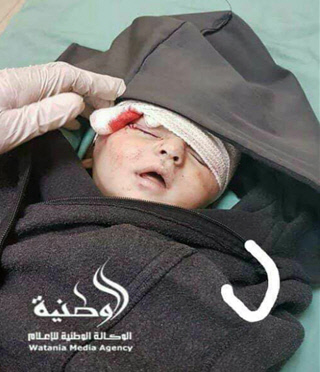 شهادت نوزاد فلسطینی در حمله صهیونیست‌ها + عکس