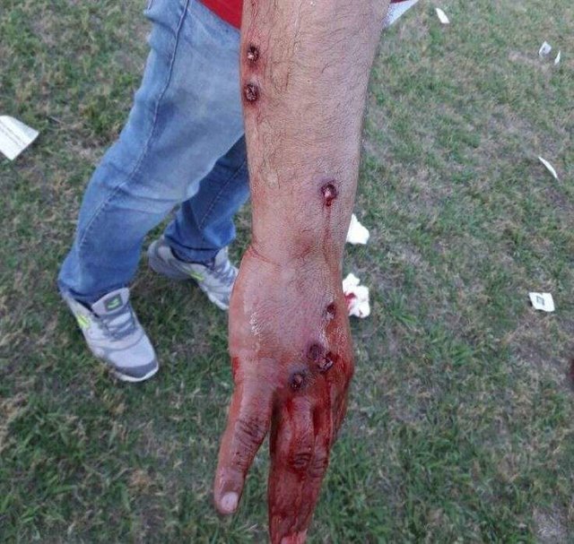 پلیس آرژانتین بازیکنان فوتبال را به گلوله بست + عکس