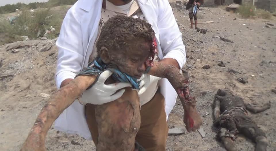 شهادت 14 یمنی در جنایت هولناک جنگنده‌های سعودی