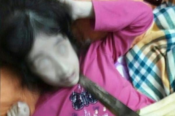 حمله پدر به دختر 17 ساله معلولش با قمه! + عکس