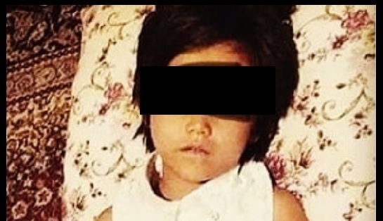 آخرین وضعیت دختربچه مهاجر افغان در خمینی شهر