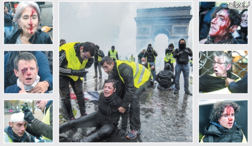 اینجا فرانسه، مهد حقوق بشر!+عکس
