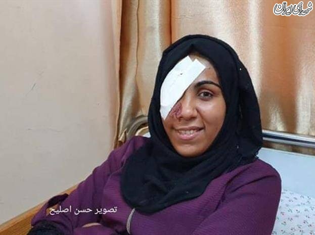 عکس/ سرباز صهیونیست چشم دختر فلسطینی را درآورد