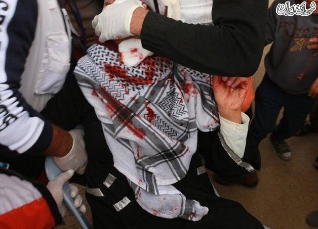 عکس/ سرباز صهیونیست چشم دختر فلسطینی را درآورد