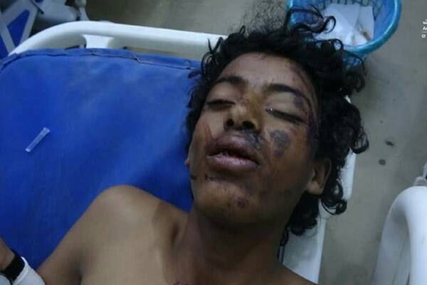 جنایت جدید ائتلاف سعودی علیه غیرنظامیان یمنی +عکس