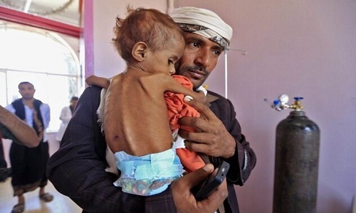 ۲ واقعیت بزرگی که جنگ یمن برای جهان فاش کرد