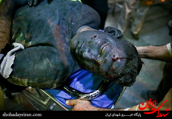 تصاویر/ مصدومان شب چهارشنبه آخر سال - بیمارستان ۱۵ خرداد