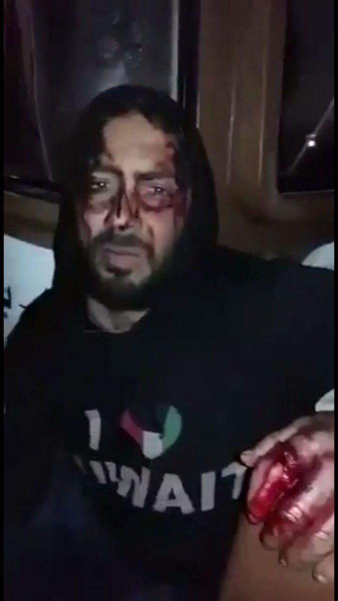 نظامیان کویتی انگشت صیاد ایرانی را بریدند!+عکس