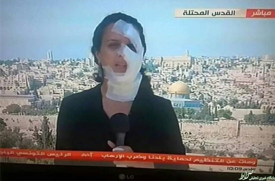 خبرنگار زخمی روی آنتن زنده تلویزیون + عکس