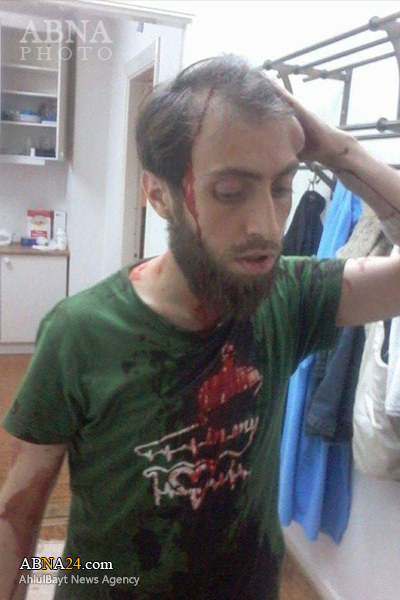 ضرب‌ و شتم یک پناهجوی سوری در سوئد!+عکس