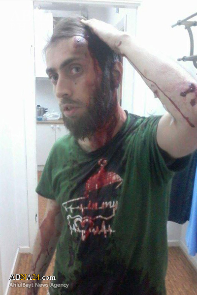 ضرب‌ و شتم یک پناهجوی سوری در سوئد!+عکس