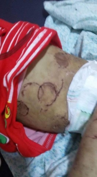 پدری بدن دخترش را مانند سگ گاز گرفت! + عکس