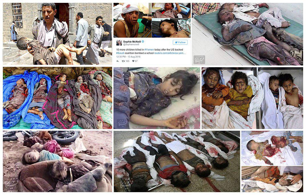 گزارش مستند از 1200 روز تجاوز به یمن/اینجا هر شبانه‌روز 150 کودک می‌میرند
