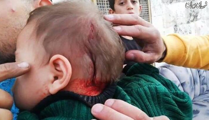 عکس/ زخمی شدن نوزاد فلسطینی توسط صهیونیست‌ها