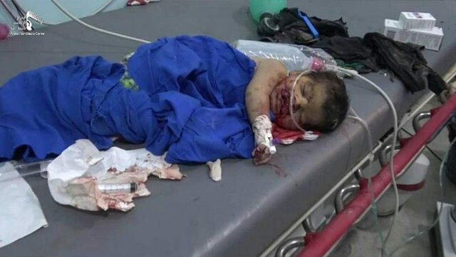 کشته و زخمی شدن ۳۶ کودک یمنی از زمان حذف نام ائتلاف عربی از لیست سیاه