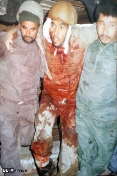 تصویر مجروحیت فرمانده گردان یاسین قبل از شهادت