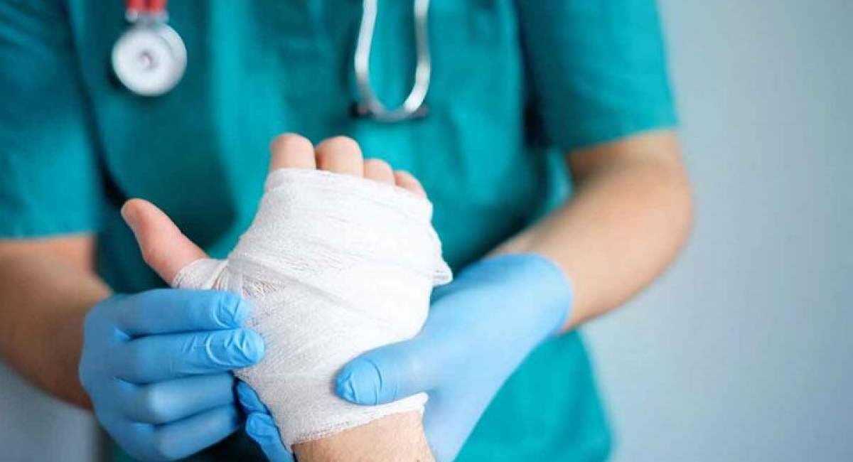 ۹۰ درصد سوختگیها قابل پیشگیری است